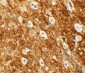 ROCK2 Antibody